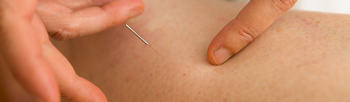 Acupuncture Banner 1-1