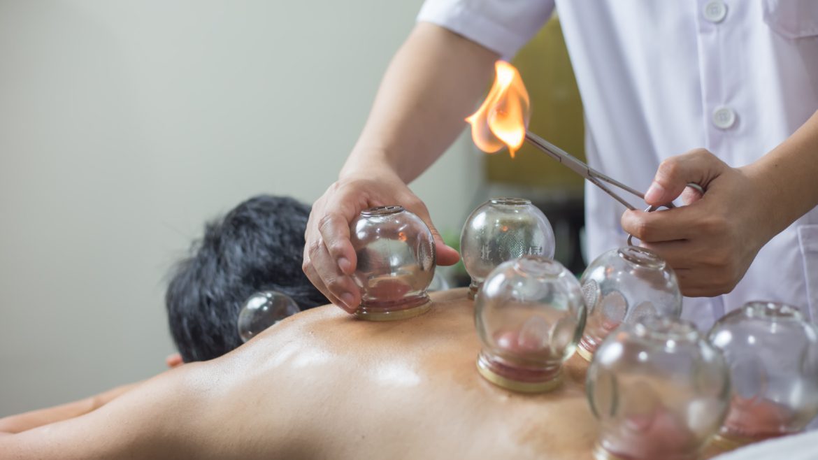 Chinese Fire Cupping