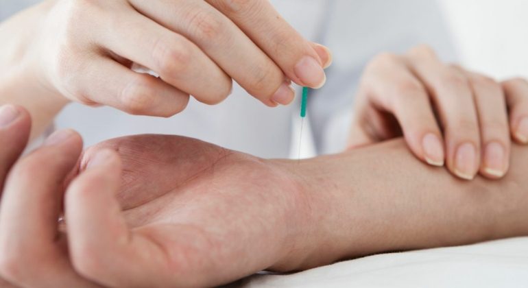 Livonia acupuncturist sticking needle into patient's wrist