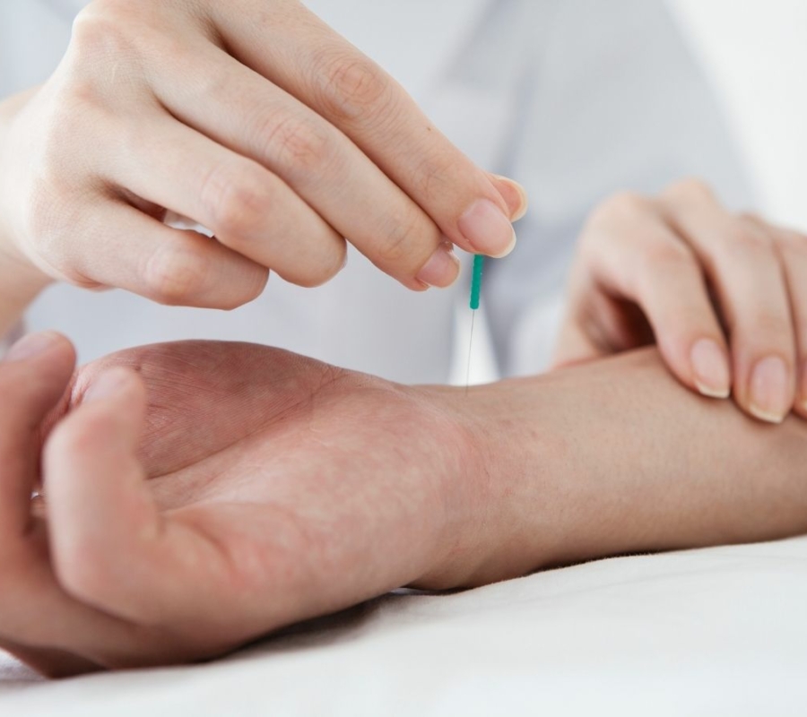 Livonia acupuncturist sticking needle into patient's wrist